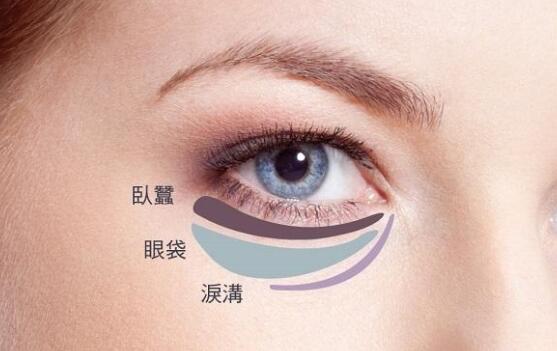 受女性欢迎的五大眼部整形之---祛眼袋