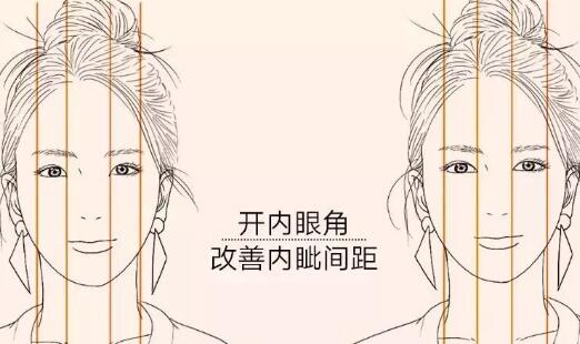 开眼角