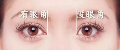 开眼角