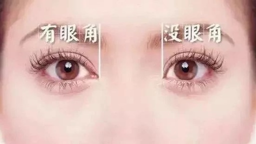 开眼角