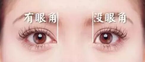 开眼角