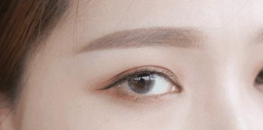 开眼角